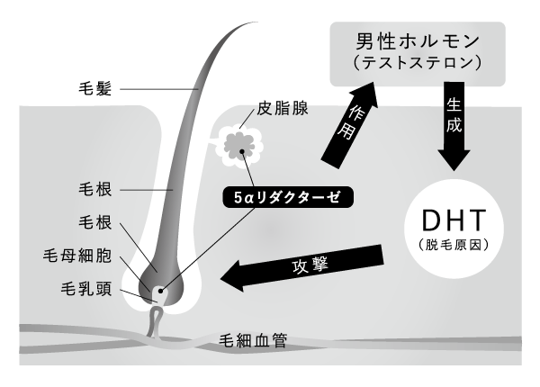 男性ホルモン